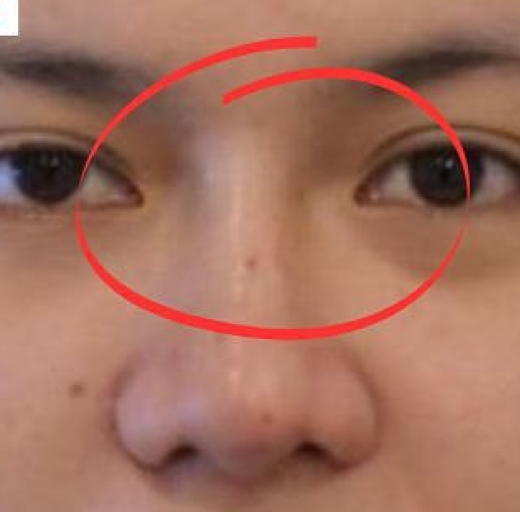 Before/After Image